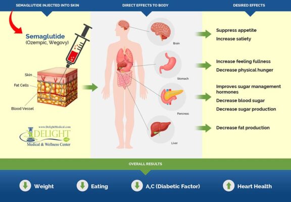 What Is Semaglutide and How Does It Work? A Complete Guide to This Popular Weight Loss and Diabetes Medication